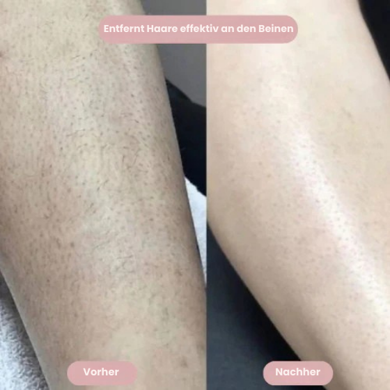 SilkySkin – Intimrasur ohne Hautirritationen